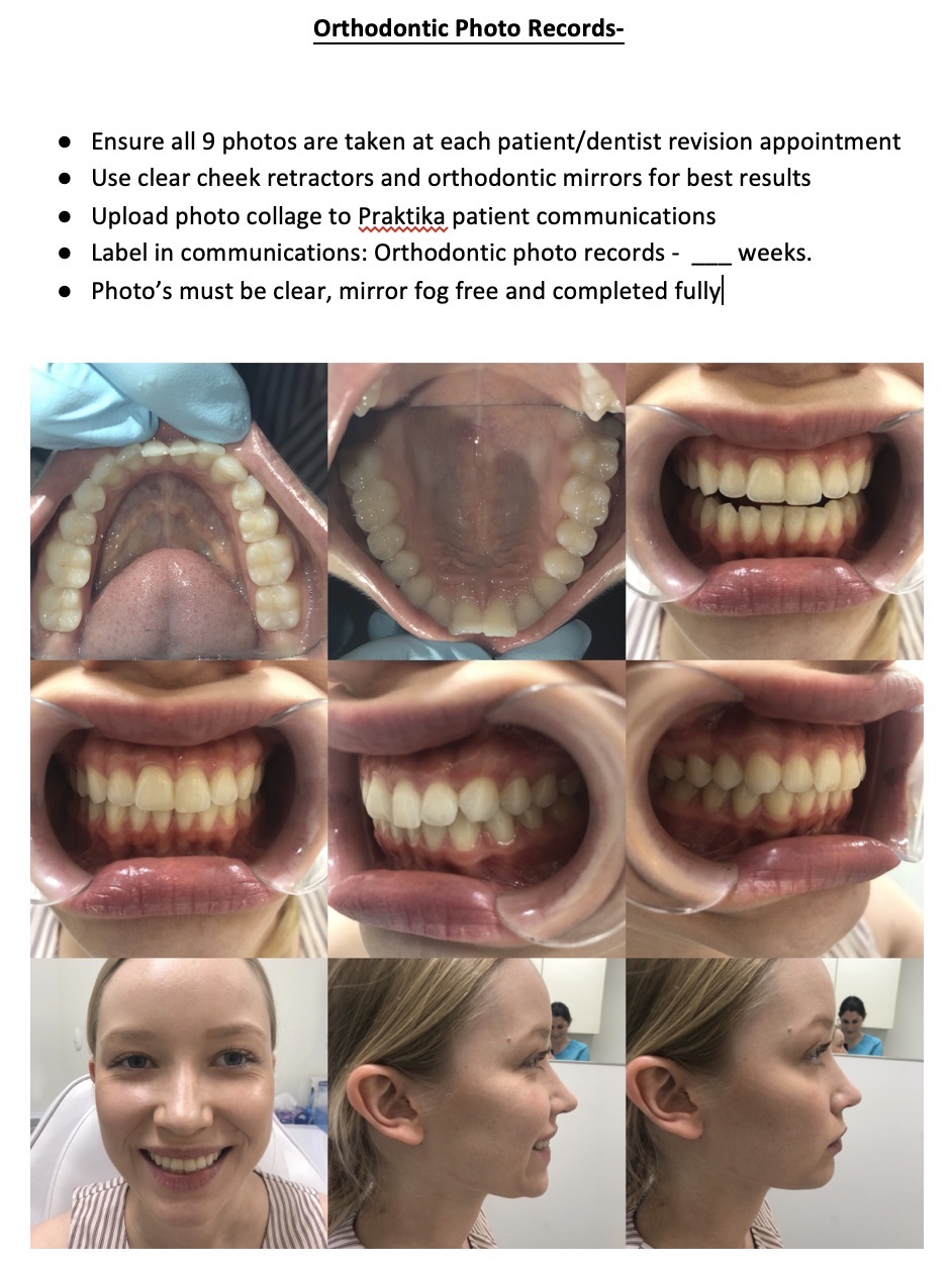 dm-clear-aligners-book